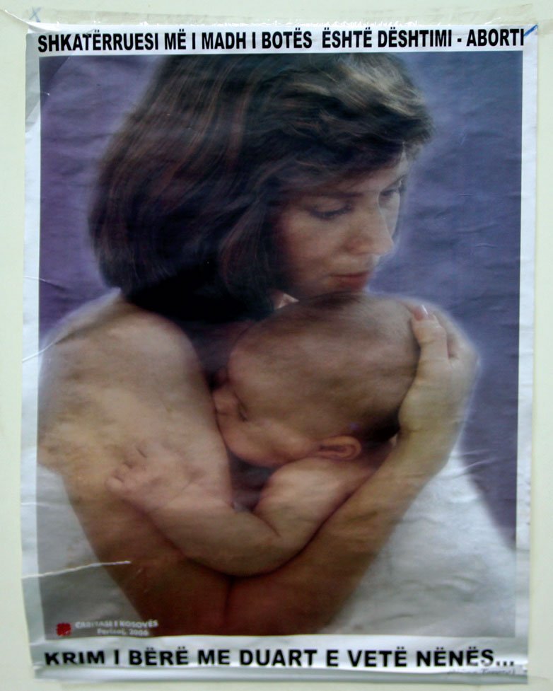 Kjo fotografi është e vendosur në sallën e aborteve në QKUK